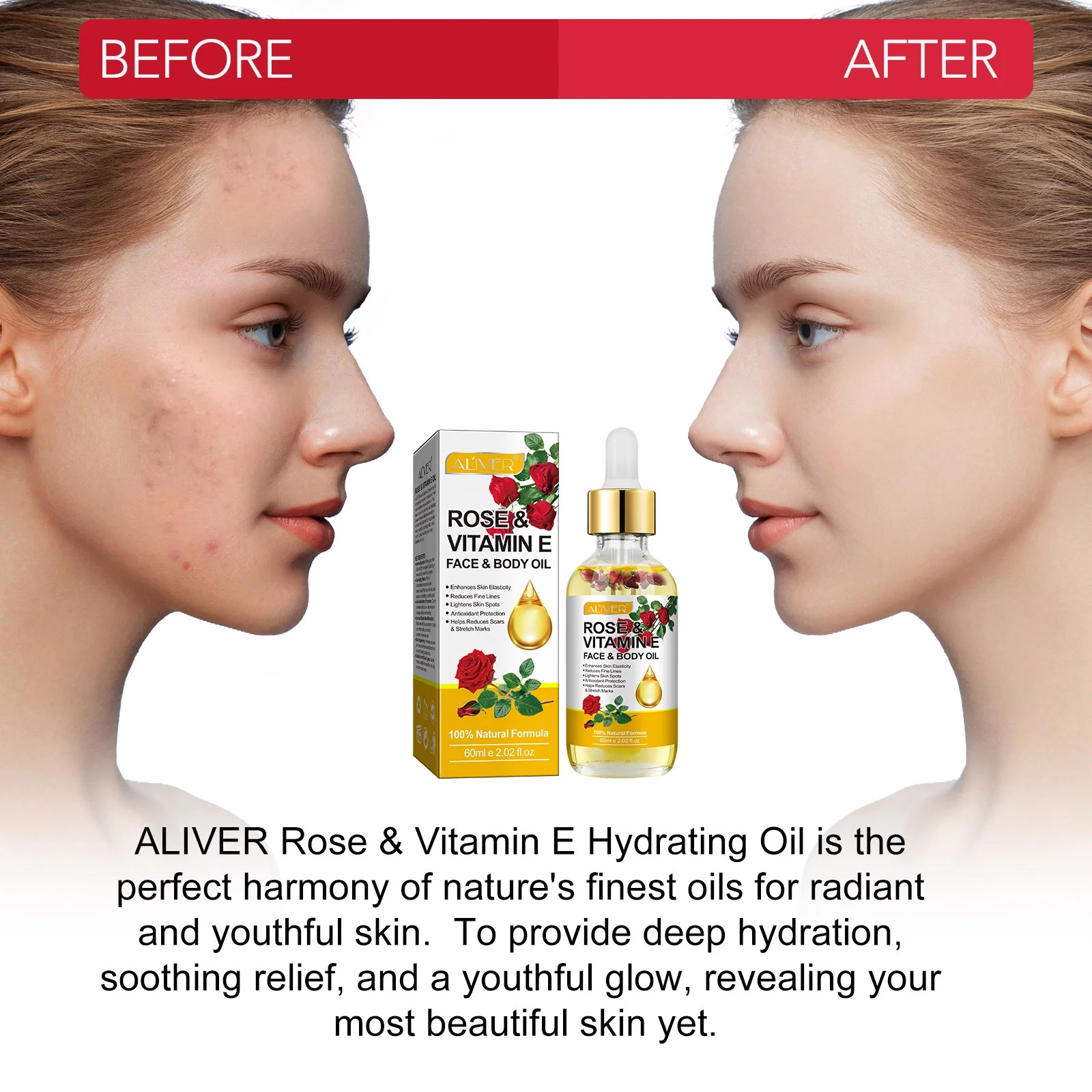 Rose & Vitamin E Hydrating Oil-Vitamin E Oil for Face & Body-Natural Formula,Int