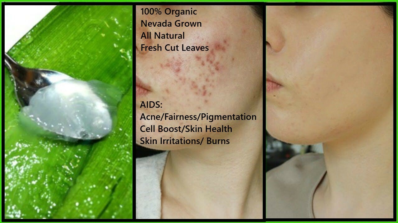 Aloe Vera Gel Barbadensis Organic Leaf, Edible Vitamins Minerals